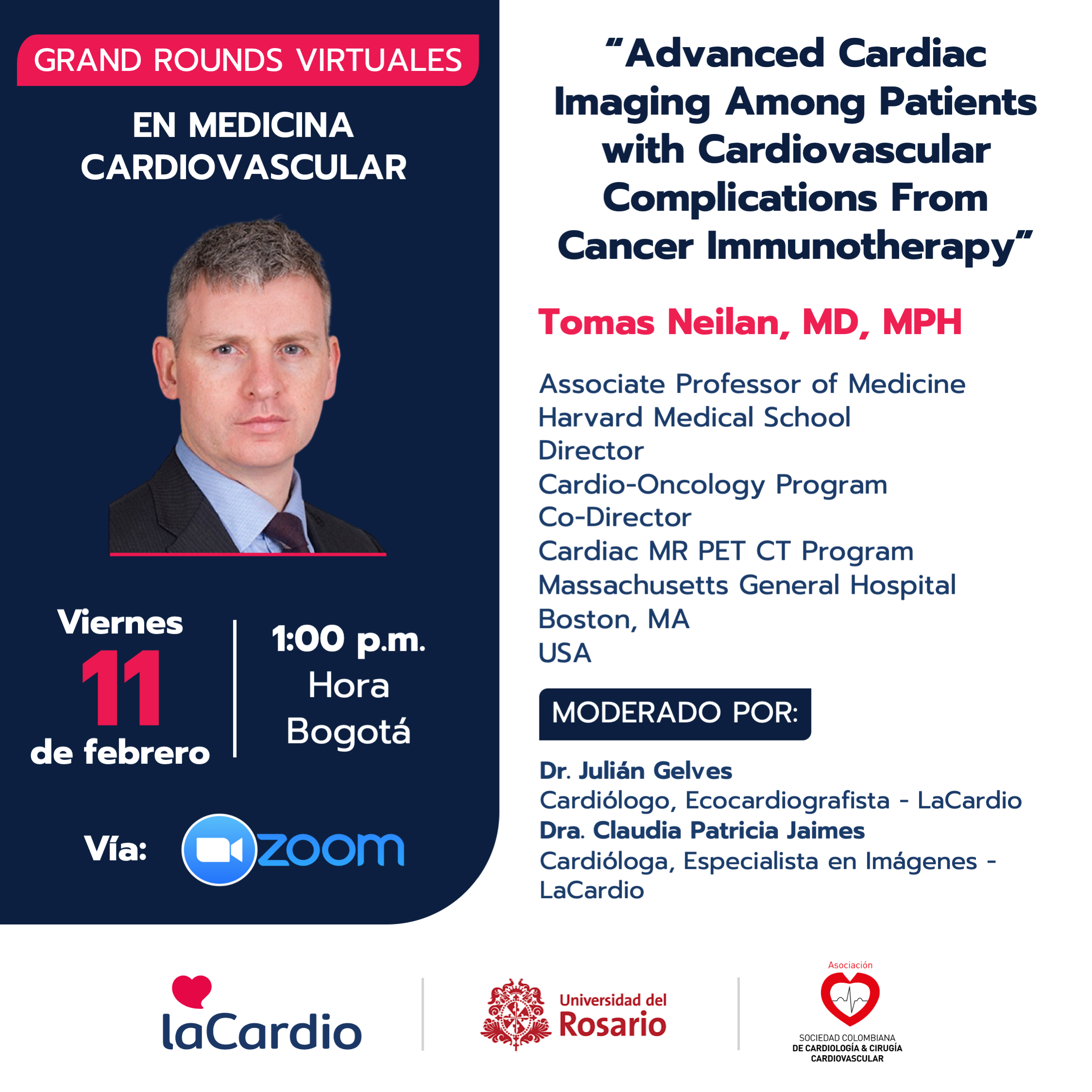 Grand Rounds en Medicina Cardiovascular: Advanced Cardiac Imaging Among Patients with Cardiovascular Complications From Cancer Immunotherapy